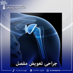 جراحی تعویض مفصل - دکتر حمید پردیس