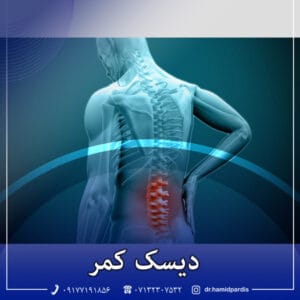 دیسک کمر - دکتر پردیس