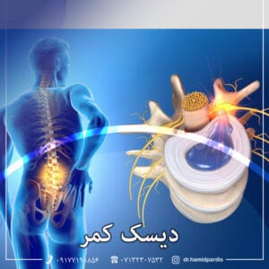 دیسک کمر - دکتر پردیس