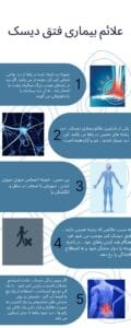 علائم بیماری فتق دیسک - دکتر حمید پردیس