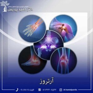 آرتروز - دکتر حمید پردیس