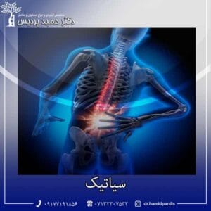 سیاتیک - دکتر حمید پردیس