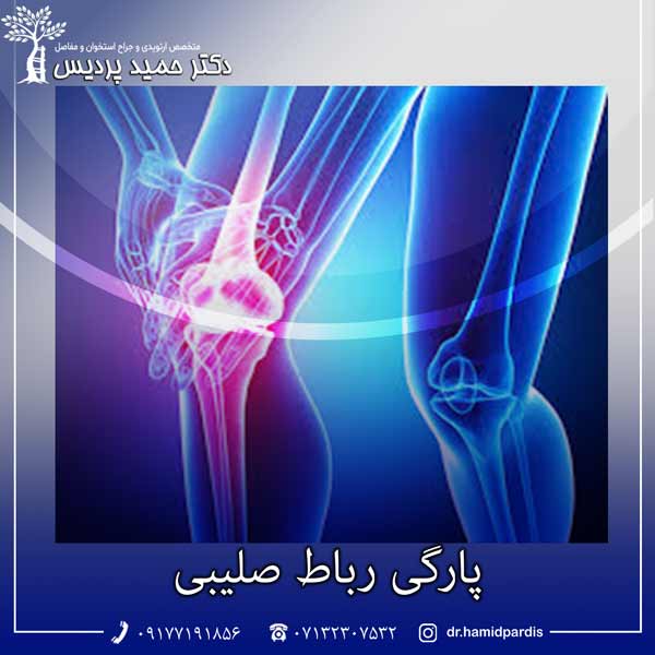 پارگی رباط صلیبی - دکتر حمید پردیس