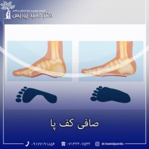 صافی کف پا - دکتر حمید پردیس