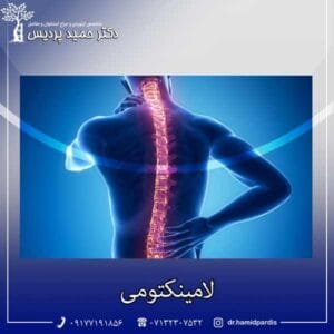 لامینکتومی - دکتر حمید پردیس
