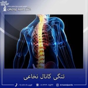 تنگی پارگی کانال نخاعی - دکتر حمید پردیس