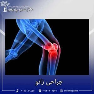 جراحی زانو - دکتر حمید پردیس