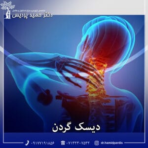 دیسک گردن - دکتر حمید پردیس