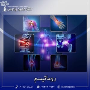 روماتیسم - دکتر حمید پردیس