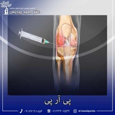 پی آر پی - دکتر حمید پردیس
