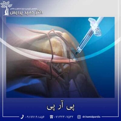 پی آر پی - دکتر حمید پردیس