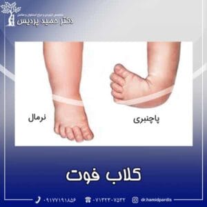 کلاب فوت - دکتر حمید پردیس