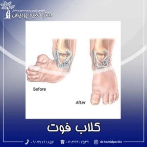 کلاب فوت - دکتر حمید پردیس