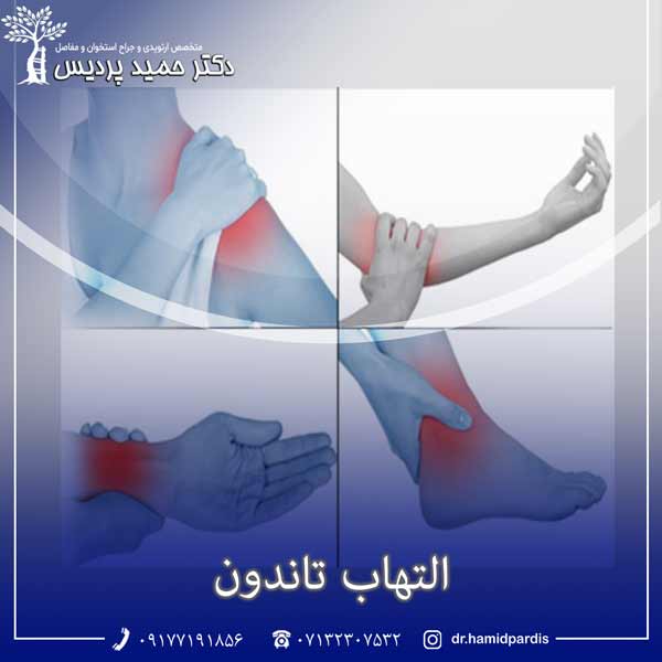التهاب تاندون - دکتر حمید پردیس
