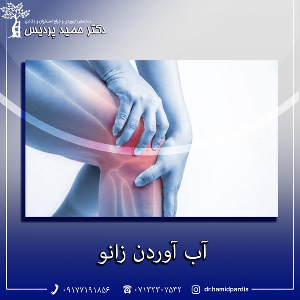 آب آوردن زانو - دکتر حمید پردیس