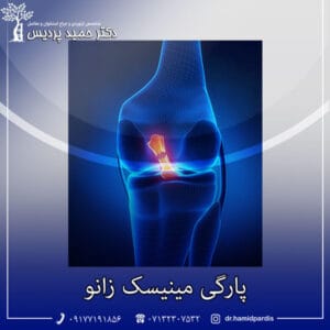 پارگی مینیسک زانو - دکتر حمید پردیس