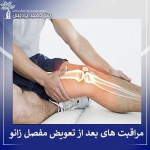 مراقبت های بعد از تعویض مفصل زانو - دکتر حمید پردیس 