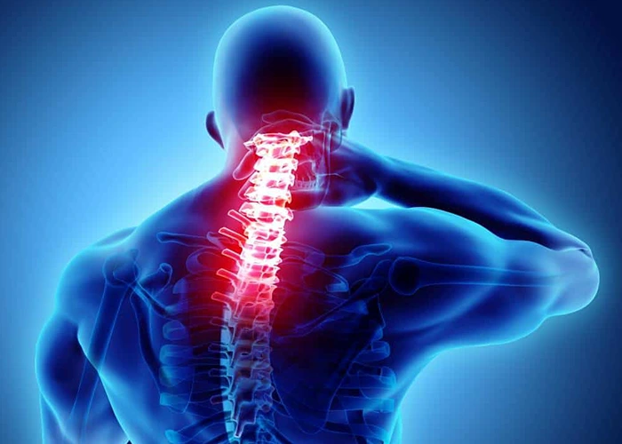 علائم و مشکلات ناشی از کیفوز