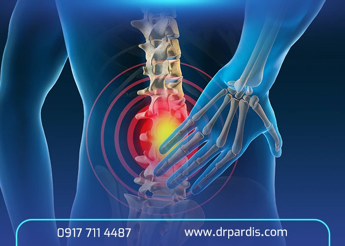 راه‌های پیشگیری مؤثر از عود دیسک کمر