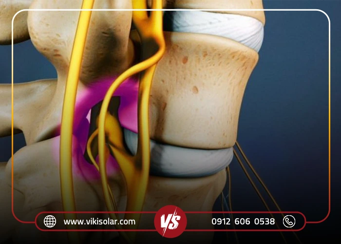 تغذیه و سبک زندگی برای کاهش علائم
