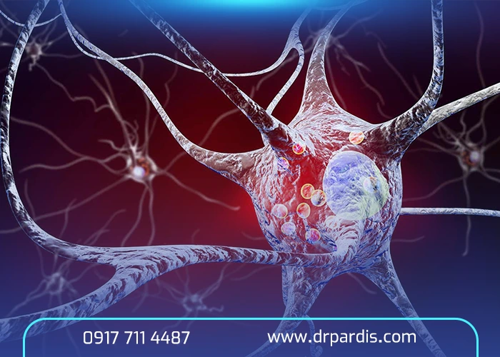 علائم اولیه بیماری پارکینسون