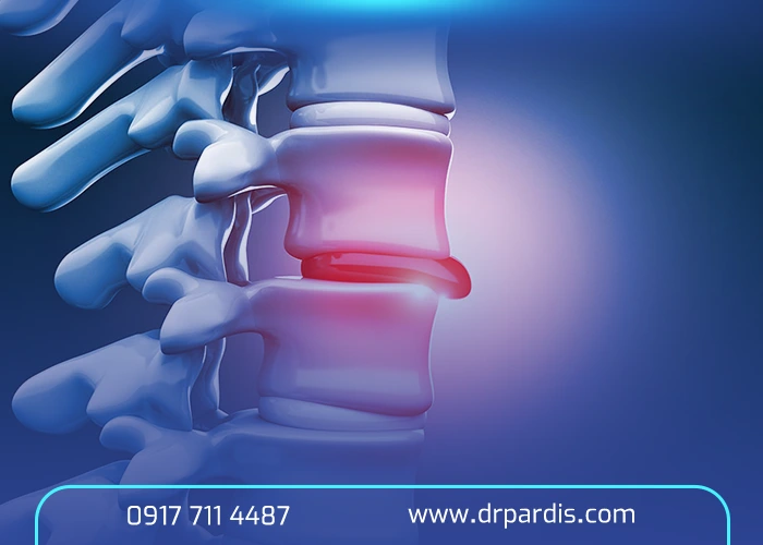 علائم دیسک کمر خطرناک در جدول