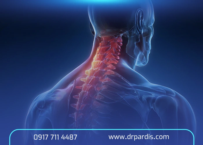 درمان ديسک گردن در شیراز
