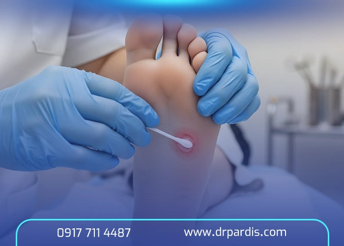 تزريق ژل خار پاشنه