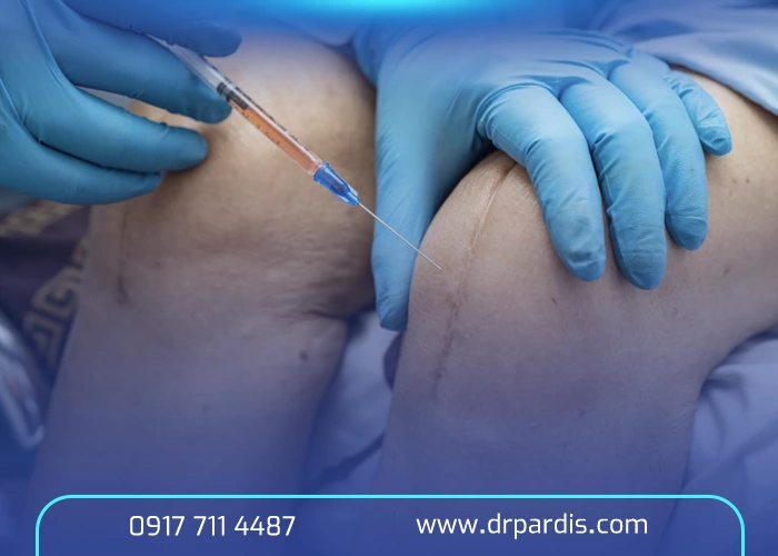 تزريق ژل زانو