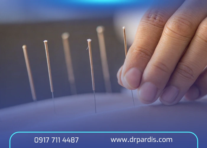 آیا دیسک کمر با طب سوزنی درمان می‌شود؟