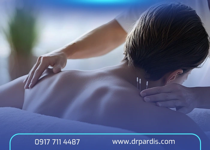 درمان دیسک کمر با طب سوزنی