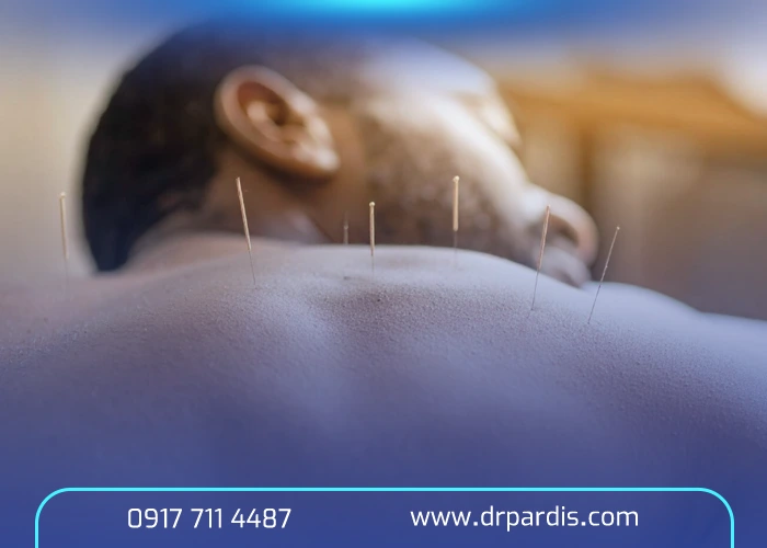 آیا طب سوزنی می‌تواند دیسک کمر را «درمان» کند؟