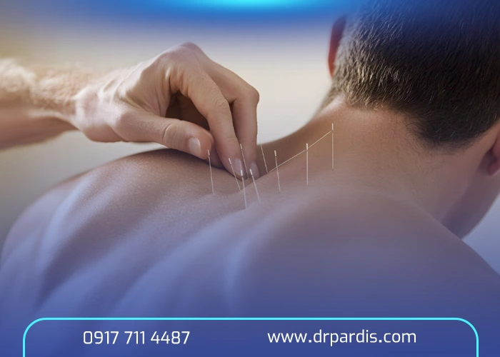 درمان دیسک کمر با طب سوزنی