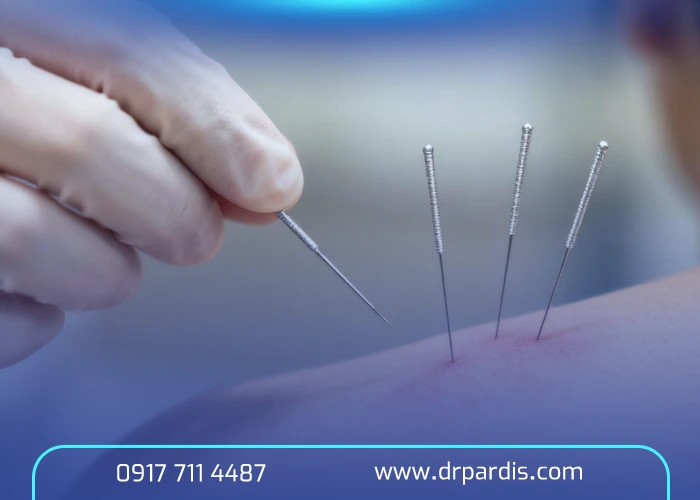 آیا دیسک کمر با طب سوزنی درمان می‌شود؟