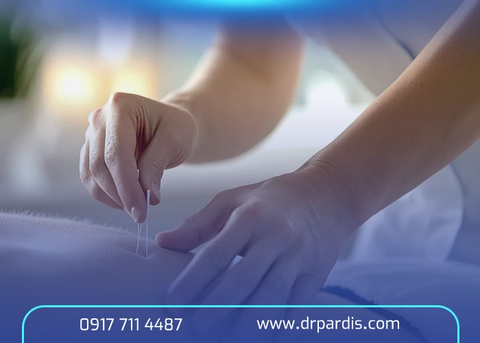 درمان دیسک کمر با طب سوزنی